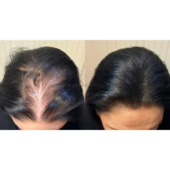 Bioelixire Expert Mikrowłókna do włosów 30g