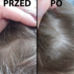 Dermz Healpsorin - zestaw na łuszczycę, ŁZS i podrażnioną skórę głowy szampon 500ml i odżywka 500ml