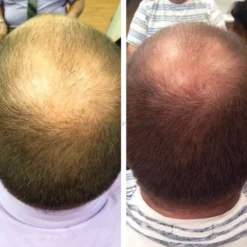 Nioxin System 4 szampon przeciw wypadaniu do włosów farbowanych 1000ml