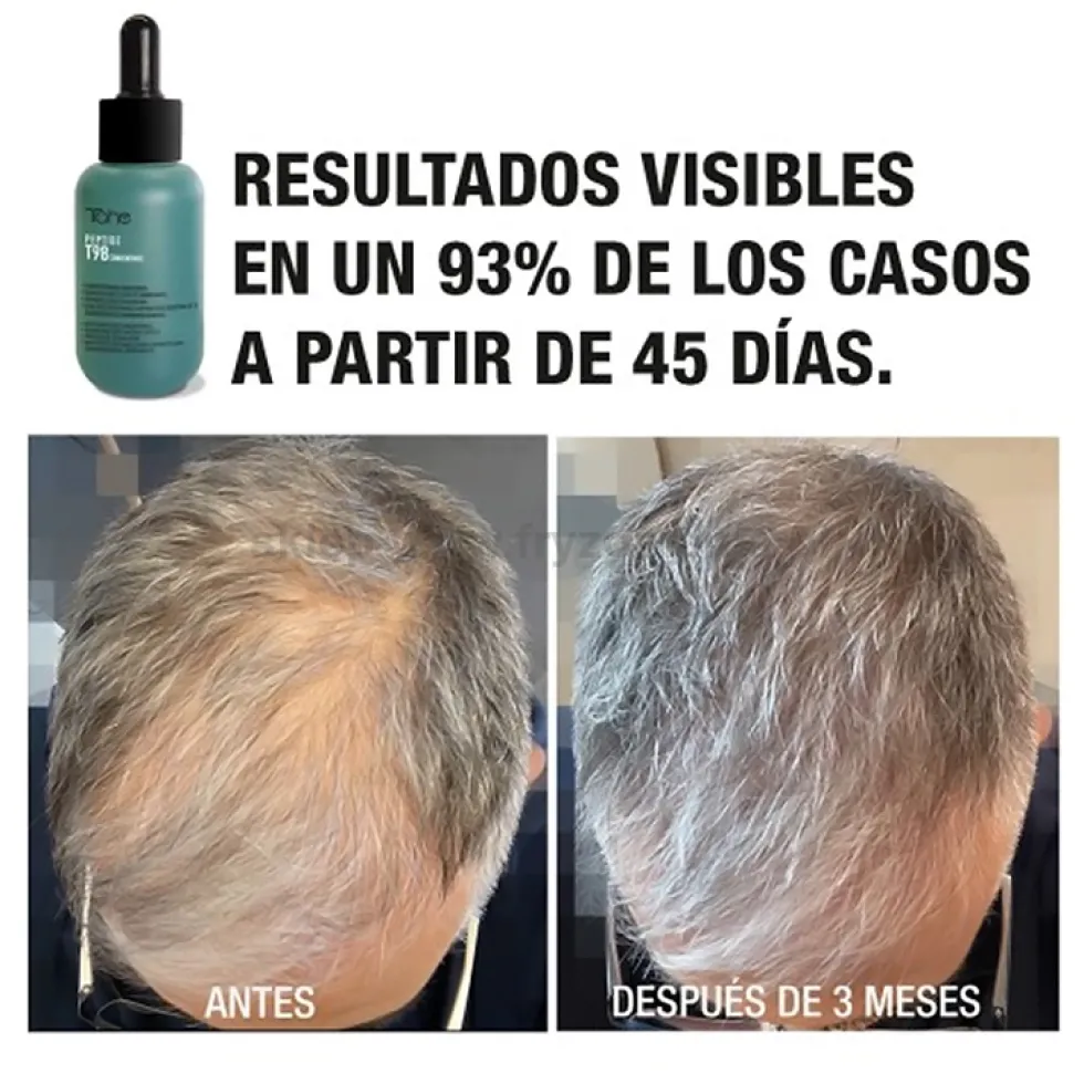Tahe Peptide T98 Koncentrat przeciw wypadaniu włosów, zagęszczający 50ml