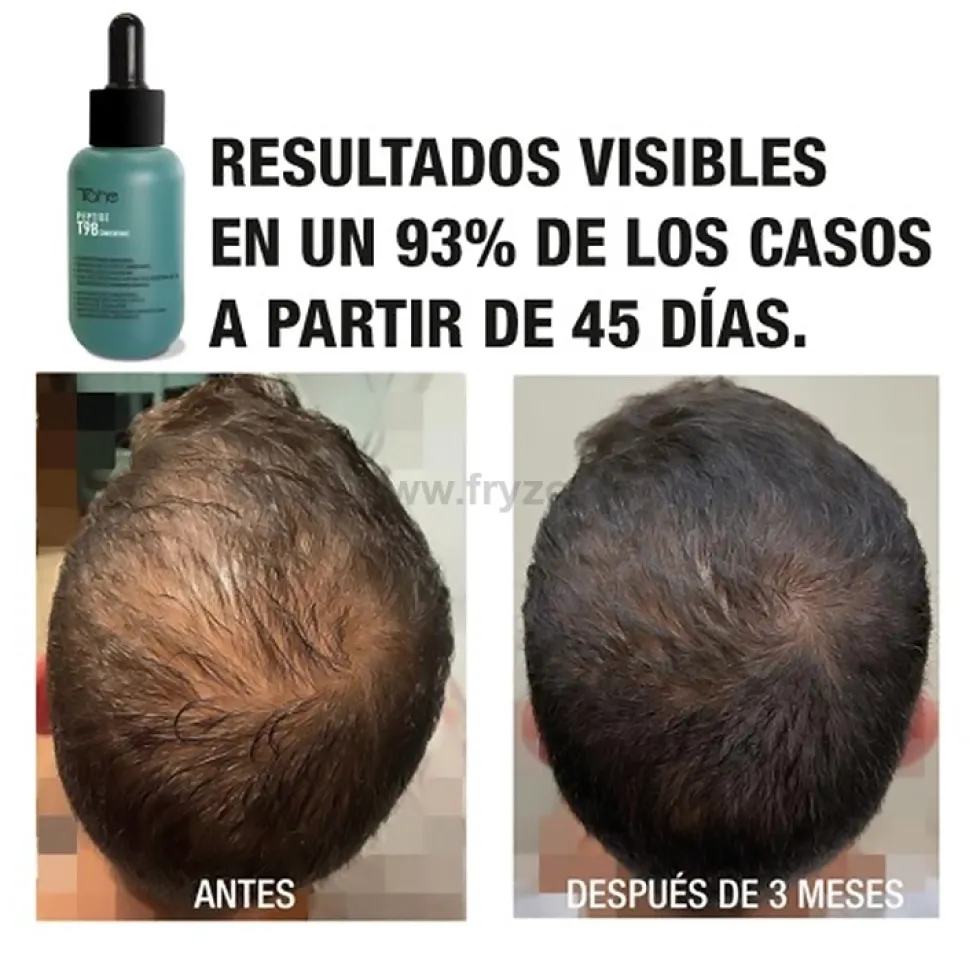 Tahe Peptide T98 Koncentrat przeciw wypadaniu włosów, zagęszczający 50ml